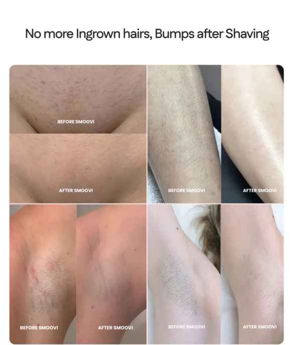 Bikini Dual Head Shaver